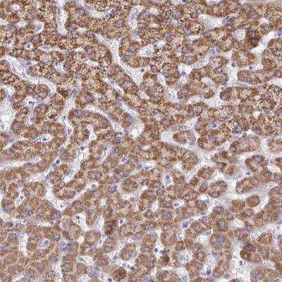 Immunohistochemistry-Paraffin: ACSM2A Antibody [NBP2-46841]