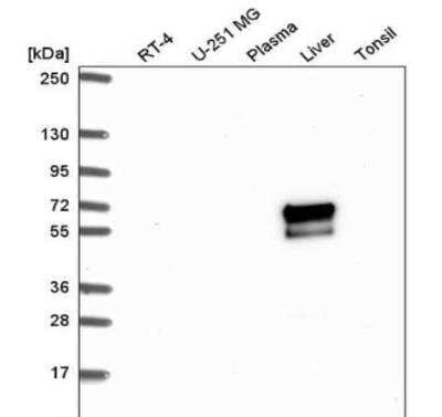 Western Blot: ACSM2A Antibody [NBP2-46841]