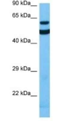 Western Blot: ACSM2A Antibody [NBP3-10849]