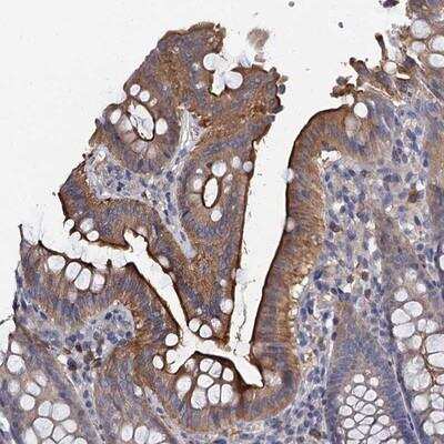 Immunohistochemistry: ACSM3 Antibody [NBP1-87098]