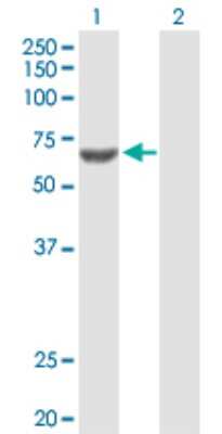 Western Blot: ACSM3 Antibody [H00006296-B01P]