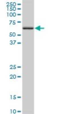 Western Blot: ACSM3 Antibody [H00006296-D01P]