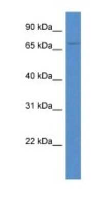 Western Blot: ACSM3 Antibody [NBP1-74081]