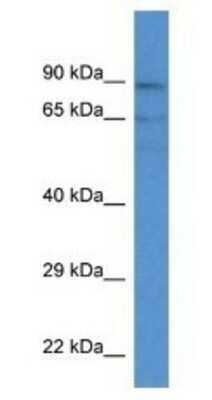 Western Blot: ACSM3 Antibody [NBP1-74275]