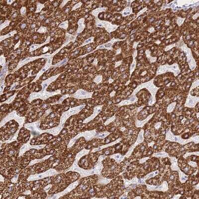 Immunohistochemistry-Paraffin: ACSM4 Antibody [NBP2-14696]