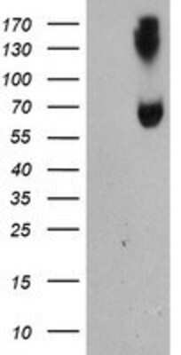 Western Blot: ACSM5 Antibody (OTI1G1) [NBP2-01874]