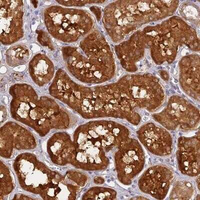 Immunohistochemistry-Paraffin: ACSM5 Antibody [NBP1-91646]