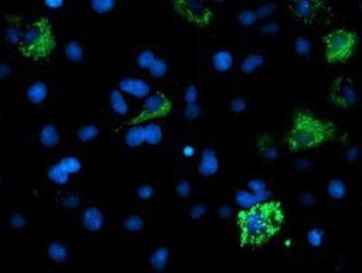 Immunocytochemistry/ Immunofluorescence: ACSM5 Antibody (OTI1G1) - Azide and BSA Free [NBP2-71978]