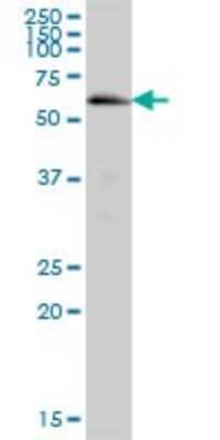 Western Blot: ACSM5 Antibody [H00054988-B01P]