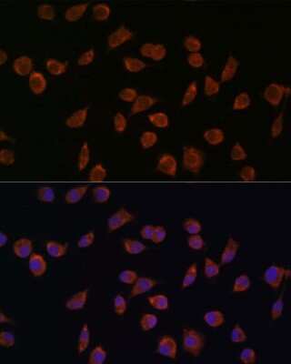 Immunocytochemistry/ Immunofluorescence: ACSS1 Antibody - Azide and BSA Free [NBP2-92202]