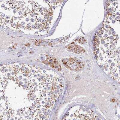 Immunohistochemistry-Paraffin: ACSS1 Antibody [NBP2-30635]