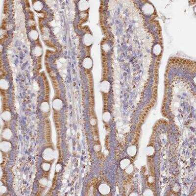 Immunohistochemistry-Paraffin: ACSS1 Antibody [NBP2-30635]