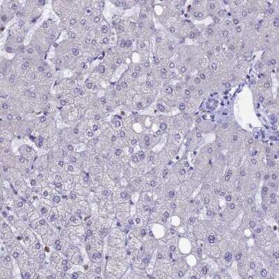 Immunohistochemistry-Paraffin: ACSS1 Antibody [NBP2-30612]