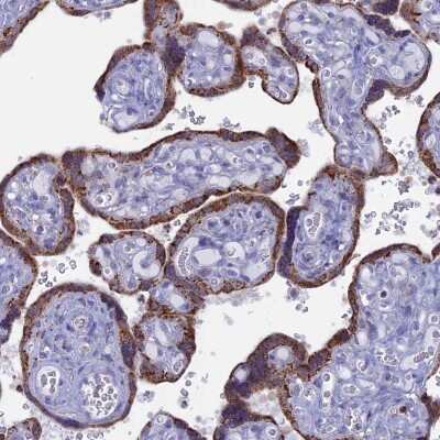 Immunohistochemistry-Paraffin: ACSS1 Antibody [NBP2-30612]