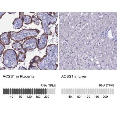 Immunohistochemistry-Paraffin: ACSS1 Antibody [NBP2-30612]