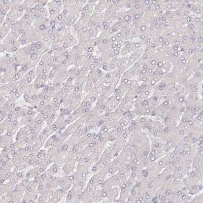 Immunohistochemistry-Paraffin: ACSS1 Antibody [NBP2-30635]