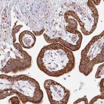 Immunohistochemistry-Paraffin: ACSS1 Antibody [NBP2-30635]