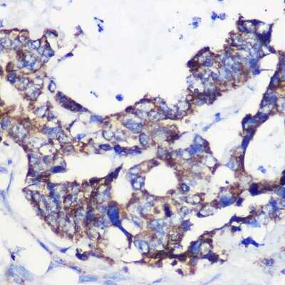 Immunohistochemistry-Paraffin: ACSS1 Antibody - Azide and BSA Free [NBP2-92202]