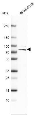 Western Blot: ACSS1 Antibody [NBP2-30635]