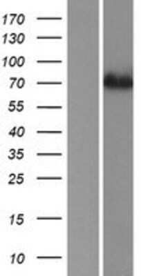 Western Blot: ACSS1 Overexpression Lysate [NBP2-06010]