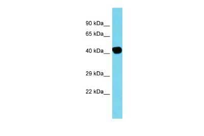 Western Blot: ACTBL2 Antibody [NBP3-09672]