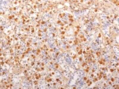 Immunohistochemistry-Paraffin: ACTH Antibody (2F6) - N-terminal - Azide and BSA Free [NBP2-34529]