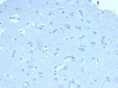 Immunohistochemistry-Paraffin: ACTH Antibody (57) - N-terminal - Azide and BSA Free [NBP2-34512]