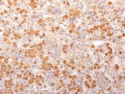 Immunohistochemistry-Paraffin: ACTH Antibody (57) - N-terminal [NBP2-32912]