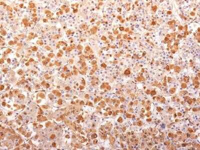 Immunohistochemistry-Paraffin: ACTH Antibody (AH26 + 57) - N-terminal - Azide and BSA Free [NBP2-34550]