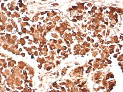 Immunohistochemistry-Paraffin: ACTH Antibody (AH26) - Azide and BSA Free [NBP2-33072]