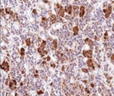 Immunohistochemistry-Paraffin: ACTH Antibody (AH26) [NBP2-29452]
