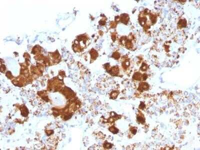 Immunohistochemistry-Paraffin: ACTH Antibody (CLIP/1407) - Azide and BSA Free [NBP2-47683]