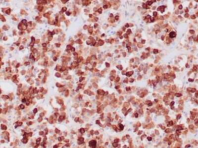Immunohistochemistry-Paraffin: ACTH Antibody (CLIP/1407) - Azide and BSA Free [NBP2-47683]