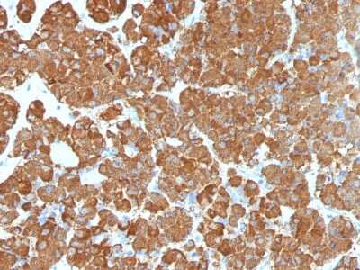 Immunohistochemistry-Paraffin: ACTH Antibody (CLIP/1407) - Azide and BSA Free [NBP2-47683]