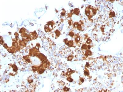 Immunohistochemistry-Paraffin: ACTH Antibody (CLIP/1407) [NBP2-47658]