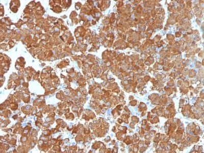 Immunohistochemistry-Paraffin: ACTH Antibody (CLIP/1407) [NBP2-47658]