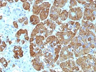 Immunohistochemistry-Paraffin: ACTH Antibody (CLIP/1449) - C-terminus - Azide and BSA Free [NBP2-54324]