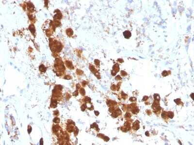 Immunohistochemistry-Paraffin: ACTH Antibody (SPM333) - Azide and BSA Free [NBP2-34761]