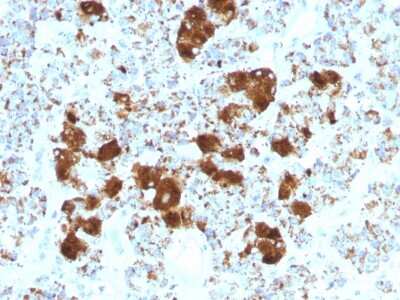 Immunohistochemistry-Paraffin: ACTH Antibody (SPM501) - C-terminus - Azide and BSA Free [NBP2-54325]