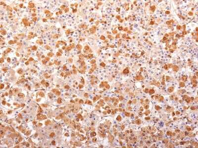 Immunohistochemistry-Paraffin: ACTH Antibody (r57) - N-terminal - Azide and BSA Free [NBP2-54342]