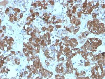 Immunohistochemistry-Paraffin: ACTH Antibody (rCLIP/1407) [NBP3-07626]