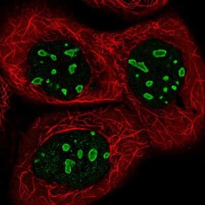 Immunocytochemistry/ Immunofluorescence: ACTL6B Antibody [NBP1-91648]