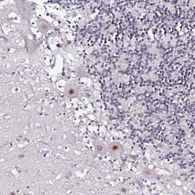 Immunohistochemistry-Paraffin: ACTL6B Antibody [NBP1-91648]