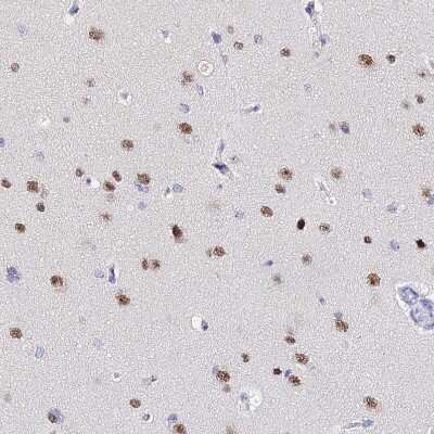 Immunohistochemistry-Paraffin: ACTL6B Antibody [NBP1-91648]