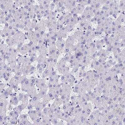 Immunohistochemistry-Paraffin: ACTL6B Antibody [NBP1-91648]