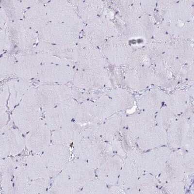 Immunohistochemistry-Paraffin: ACTL6B Antibody [NBP1-91648]