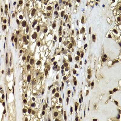 Immunohistochemistry-Paraffin: ACTL6B Antibody - BSA Free [NBP2-92909]