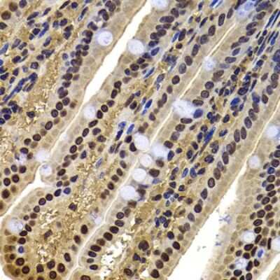 Immunohistochemistry-Paraffin: ACTL6B Antibody - BSA Free [NBP2-92909]