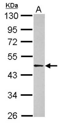 Western Blot: ACTL6B Antibody [NBP2-15269]