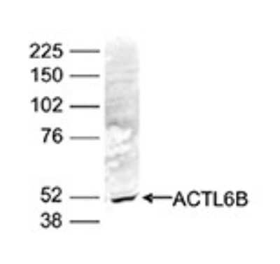 Western Blot: ACTL6B Antibody [NBP3-18635]